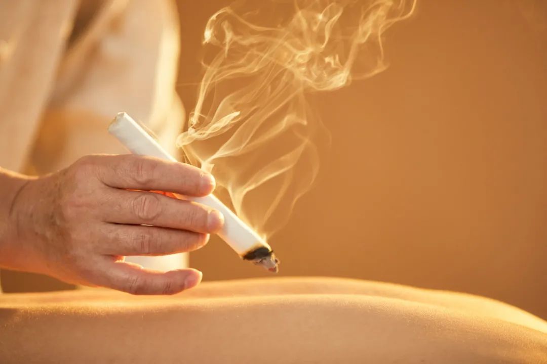 Moxibustion accessories